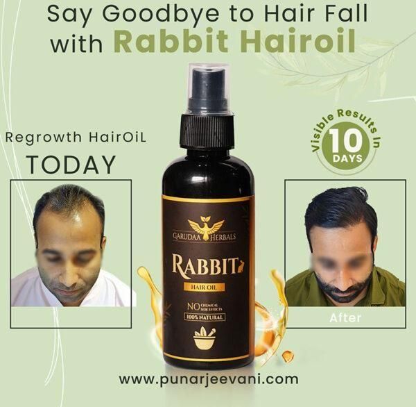 Rabbit Hair Growth Oil (Pack of 2) 🔥 BUY 1 GET 1 FREE 🔥 SALE 65% OFF🔥