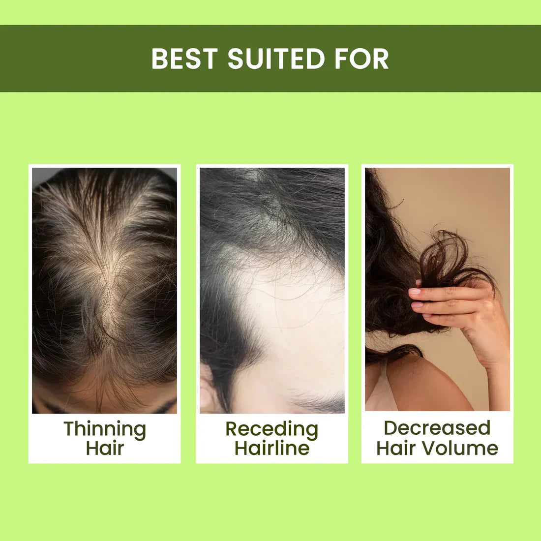 Rosemary Water Spray for Hair Regrowth – 🔥BUY 1 GET 2 FREE🔥