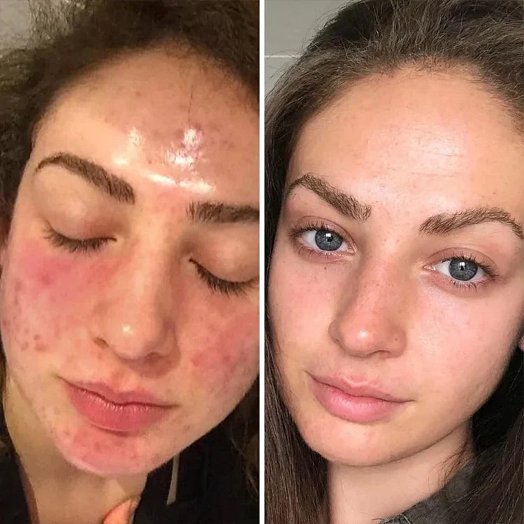 Korean Collagen Night Wrapping Peel-Off Mask | 🔥 60% OFF Today Only! 🔥